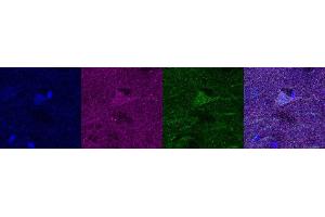 Immunohistochemistry (IHC) image for anti-Ubiquitin Carboxyl-terminal Esterase L1 (Ubiquitin Thiolesterase) (UCHL1) antibody (ABIN7456137) (UCHL1 抗体)