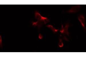 Immunofluorescence (fixed cells) (IF/ICC) image for anti-ATP-Binding Cassette, Sub-Family B (MDR/TAP), Member 10 (ABCB10) (Internal Region) antibody (ABIN6257917)