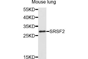 Western blot analysis of extracts of mouse lung, using SRSF2 antibody (ABIN5995581) at 1/1000 dilution. (SRSF2 抗体)