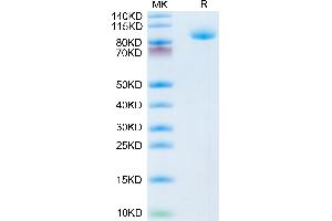 Lrig1 Protein (AA 35-779) (His tag)