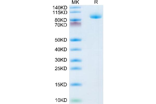 Lrig1 Protein (AA 35-779) (His tag)
