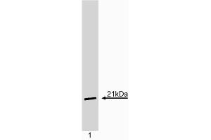 Western blot analysis of p21. (p21 抗体)