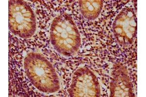 Immunohistochemistry (IHC) image for anti-Proteasome (Prosome, Macropain) Subunit, beta Type, 9 (Large Multifunctional Peptidase 2) (PSMB9) (AA 21-219) antibody (ABIN7164994)