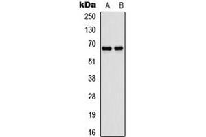 Western blot analysis of ATG16L1 expression in SHSY5Y (A), rat muscle (B) whole cell lysates. (ATG16L1 抗体  (Center))