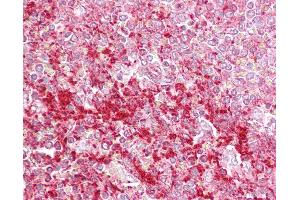 Anti-ETV5 antibody IHC of human spleen. (ETV5 抗体  (N-Term))