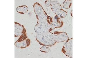 Immunohistochemistry of paraffin-embedded human placenta using S antibody (ABIN6132970, ABIN6147387, ABIN6147388 and ABIN6215904) at dilution of 1:100 (40x lens). (SARS2 抗体  (AA 289-518))