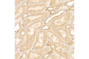 Immunohistochemistry of paraffin-embedded rat kidney using PFKP antibody (ABIN7269309) at dilution of 1:100 (40x lens).