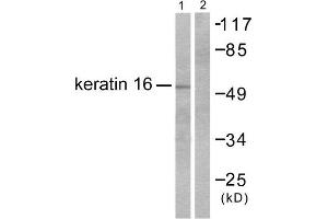 Western Blotting (WB) image for anti-Keratin 16 (KRT16) (C-Term) antibody (ABIN1848628) (KRT16 抗体  (C-Term))