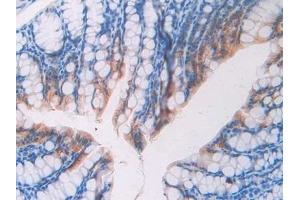 Detection of FBLN4 in Mouse Colon Tissue using Polyclonal Antibody to Fibulin 4 (FBLN4) (FBLN4 抗体  (AA 182-431))