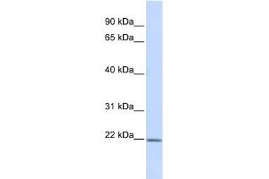 WB Suggested Anti-ZFAND5 Antibody Titration:  0. (ZFAND5 抗体  (Middle Region))