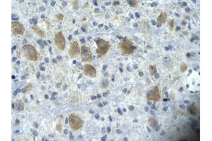 Rabbit Anti-TAF15 Antibody       Paraffin Embedded Tissue:  Human neural cell   Cellular Data:  Epithelial cells of renal tubule  Antibody Concentration:   4. (TAF15 抗体  (N-Term))