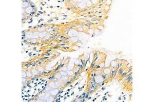 Immunohistochemistry of paraffin embedded human colon using ATP1HC1 (ABIN7073160) at dilution of 1:500 (400x lens) (ATP12A 抗体)