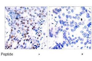 Image no. 2 for anti-Jun Proto-Oncogene (JUN) (AA 89-93) antibody (ABIN197128) (C-JUN 抗体  (AA 89-93))