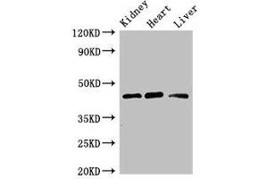 Western Blot Positive WB detected in: Mouse kidney tissue, Rat heart tissue, Rat liver tissue All lanes: WTAP antibody at 3 μg/mL Secondary Goat polyclonal to rabbit IgG at 1/50000 dilution Predicted band size: 45, 18 kDa Observed band size: 45 kDa (WTAP 抗体  (AA 1-151))