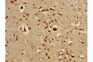 Immunohistochemistry of paraffin-embedded human brain tissue using ABIN7142174 at dilution of 1:100 (OAS3 抗体  (AA 424-565))