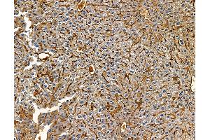 ABIN7095879 and ABIN7099941 at 1/100 staining mouse liver tissue by IHC-P.