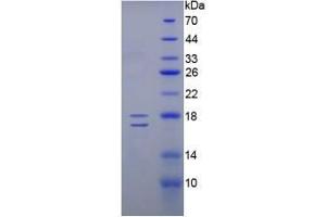 SDS-PAGE analysis of Human Inhibin beta E Protein. (INHBE 蛋白)