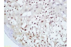 Formalin-fixed and paraffin embedded mouse placenta labeled with Anti-GnRHR Polyclonal Antibody, Unconjugated  at 1:200 followed by conjugation to the secondary antibody and DAB staining (MAF 抗体  (AA 341-403))