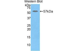 Western Blotting (WB) image for anti-Glucosidase, Beta, Acid (GBA) (AA 248-508) antibody (ABIN1858966)