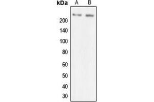 Western blot analysis of MYO7A expression in SKOVCAR (A), HEK293T (B) whole cell lysates. (Myosin VIIA 抗体  (Center))