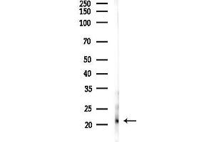 anti-Chromosome 13 Open Reading Frame 28 (C13orf28) antibody