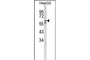 Western blot analysis of HEXA Antibody (Center) (ABIN652263 and ABIN2841133) in HepG2 cell line lysates (35 μg/lane). (Hexosaminidase A 抗体  (AA 315-343))