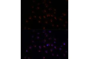 Immunofluorescence analysis of C6 cells using METTL16 antibody (ABIN7268501) at dilution of 1:100.