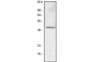 A549 (lung carcinoma) cell lysate was resolved by SDS-PAGE, transferred to PVDF membrane and probed with anti-human LYVE-1 antibody (1:500). (LYVE1 抗体  (AA 25-235))