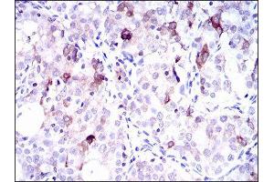 Immunohistochemistry (IHC) image for anti-Solute Carrier Family 27 (Fatty Acid Transporter), Member 5 (SLC27A5) (AA 508-570) antibody (ABIN1845743) (SLC27A5 抗体  (AA 508-570))