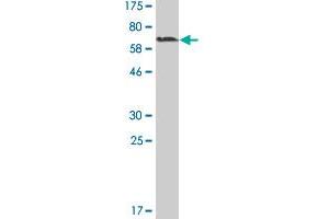 Western Blot detection against Immunogen (60. (MAGEA11 抗体  (AA 1-319))
