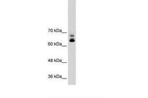 Image no. 2 for anti-Metastasis Associated 1 Family, Member 2 (MTA2) (C-Term) antibody (ABIN203470) (MTA2 抗体  (C-Term))