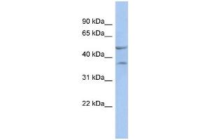 WB Suggested Anti-NKX6-1 Antibody Titration:  0. (NKX6-1 抗体  (N-Term))