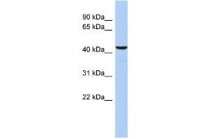 WB Suggested Anti-DFFB Antibody Titration: 0. (DFFB 抗体  (Middle Region))