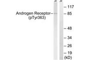 Western blot analysis of extracts from Jurkat cells treated with UV 15', using Androgen Receptor (Phospho-Tyr363) Antibody. (Androgen Receptor 抗体  (pTyr363))