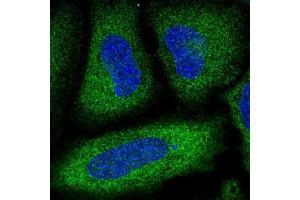 Immunofluorescent staining of HeLa cells with PDE3A polyclonal antibody  (Green) shows localization to cytosol. (PDE3A 抗体)