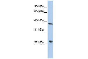 DDX25 antibody used at 1 ug/ml to detect target protein. (DDX25 抗体)