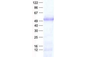 Western Blotting (WB) image for LIM Homeobox 2 (LHX2) protein (His tag) (ABIN2724718)