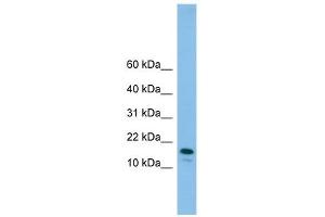GREM2 antibody used at 1 ug/ml to detect target protein. (GREM2 抗体)