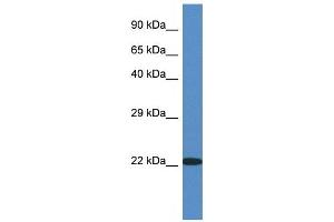 Western Blot showing RPL14 antibody used at a concentration of 1 ug/ml against Fetal Kidney Lysate (RPL14 抗体  (C-Term))