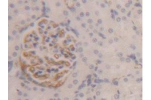 Used in DAB staining on fromalin fixed paraffin-embedded Liver tissue (Fibrinogen beta Chain 抗体  (AA 33-479))