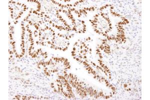 Immunohistochemistry (IHC) image for anti-Nucleolin (NCL) (AA 525-575) antibody (ABIN7453747)