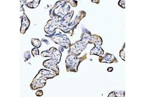 IHC analysis of PDE4DIP using anti-PDE4DIP antibody (ABIN7602691). (PDE4DIP 抗体  (AA 96-1254))