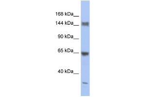 WB Suggested Anti-ATXN2 Antibody Titration:  0. (Ataxin 2 抗体  (Middle Region))