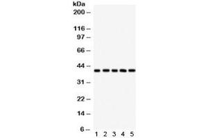 Western blot testing of 1) human HeLa, 2) human A549, 3) human U87, 4) rat brain and 5) rat liver lysate with HLA-C antibody. (HLA-C 抗体)