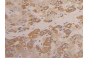 IHC-P analysis of Human Liver Tissue, with DAB staining. (INHBC 抗体  (AA 236-352))