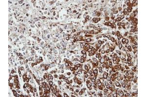 IHC-P Image Immunohistochemical analysis of paraffin-embedded MDA-MB-468 xenograft, using FPGT, antibody at 1:100 dilution. (FPGT 抗体)