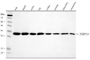 Western blot analysis of SNRPA1 using anti-SNRPA1 antibody (ABIN7599131).