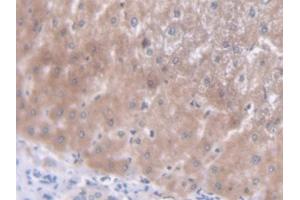 DAB staining on IHC-P; Samples: Human Liver Tissue (TREX1 抗体  (AA 6-369))