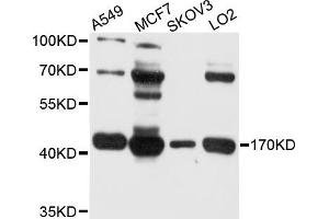 Western blot analysis of extract of various cells, using BDH1 antibody. (BDH1 抗体)