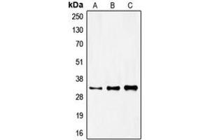 Western blot analysis of FOXR1 expression in HeLa (A), mouse kidney (B), rat kidney (C) whole cell lysates. (FOXR1 抗体  (C-Term))